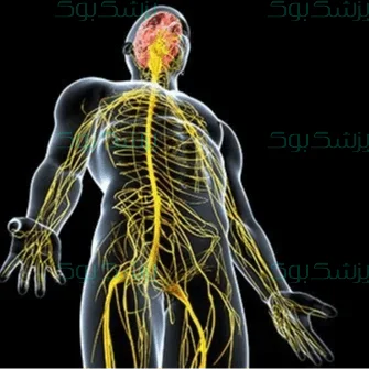 ام اس چیست؟
