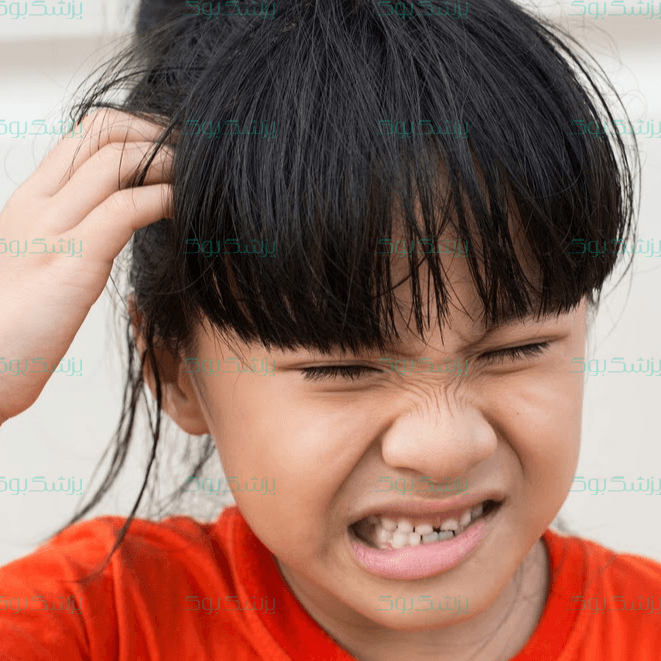 شپش؛ انواع شپش ها و راه های جلوگیری و درمان بیماری شپش