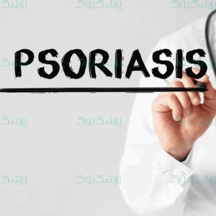 بیماری پسوریازیس نتیجه سیستم خود ایمنی بدن شما