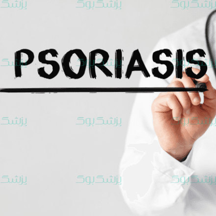 بیماری پسوریازیس نتیجه سیستم خود ایمنی بدن شما