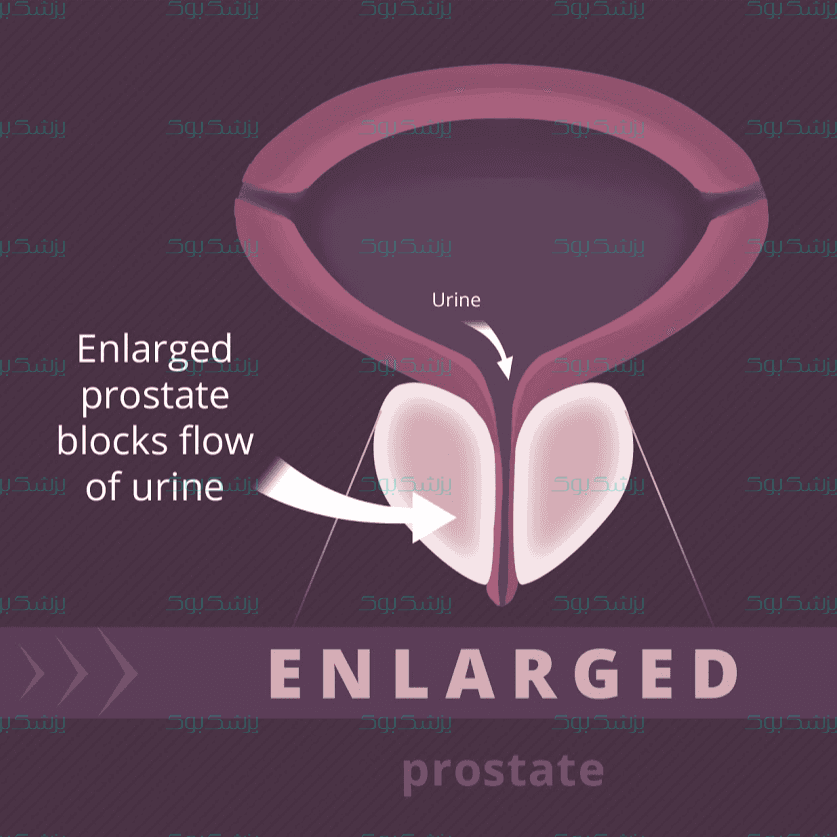در مورد پروستات بیشتر بدانیم!