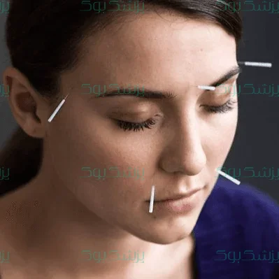 واقعا طب سوزنی معجزه می‌کند؟!