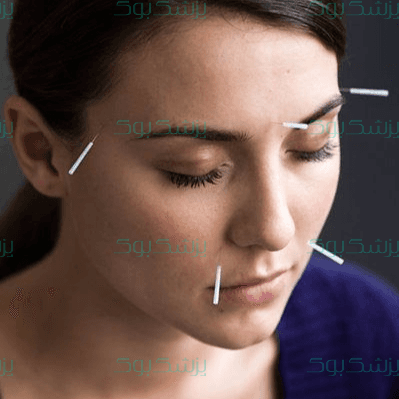 واقعا طب سوزنی معجزه می‌کند؟!