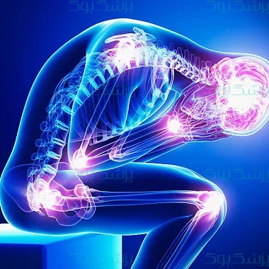 درد مزمن چیست و چگونه درمان می‌شود؟