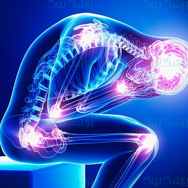 درد مزمن چیست و چگونه درمان می‌شود؟