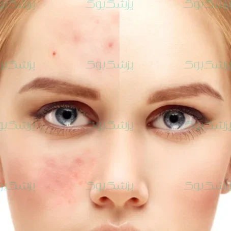 چرا پوستمان آسیب می‌بیند؟