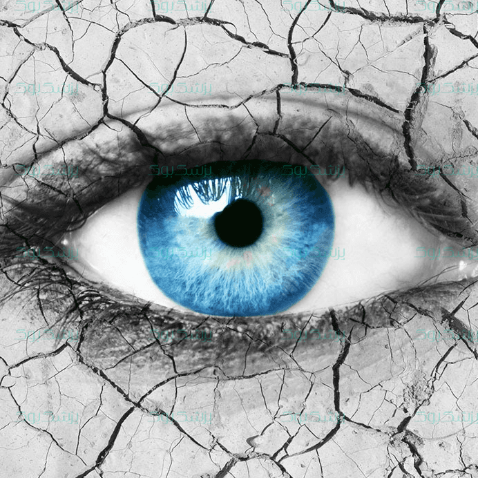 عوامل ایجاد خشکی چشم و درمان آن